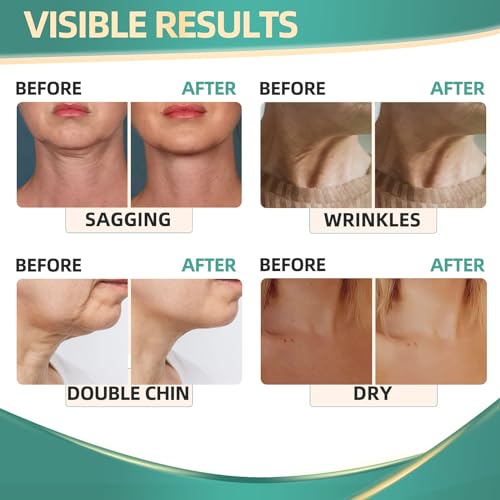 Neck Cream for Tightening Firming: Instant Face Lift Cream - Wrinkle Cream for Women RONKIE Au supplements