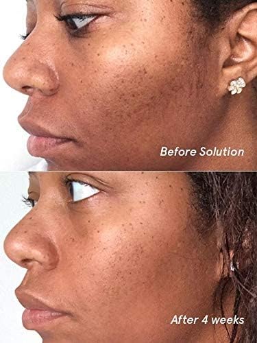Glossier Solution exfoliating skin perfector 4.4 fl oz / 130 ml Glossier Au supplements