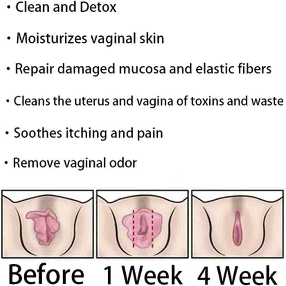 Natural Repair Vagianal Capsules, Anniecare Instant Anti-Itch Detox Slimming Products GDSAFS Au supplements