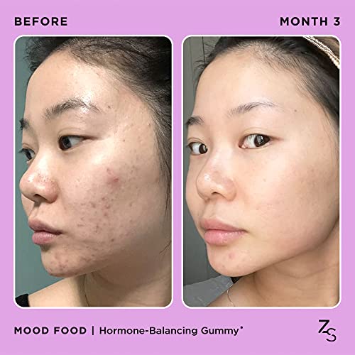 ZitSticka Mood Food: Gummy for Moody Skin + PMS Drama, Forest Berry Flavour ZitSticka Au supplements