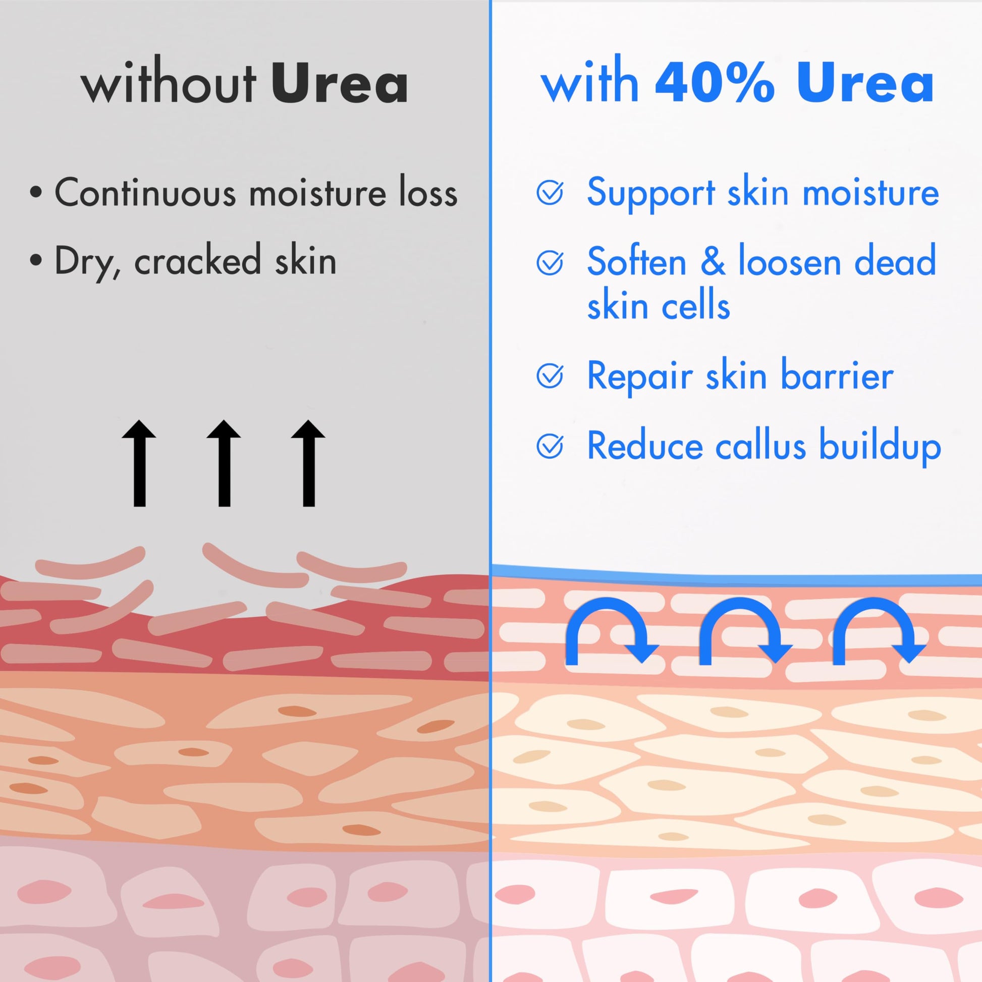 Ebanel Urea Cream 40% plus Salicylic Acid 2%, Foot Cream for Dry Cracked Heels Feet Knees Elbows Hands, Foot Dead Skin Cuticle Callus Remover Toenail Softener, Keratolytic Skin Barrier Repair, 3-Pack Ebanel buy supplements Au