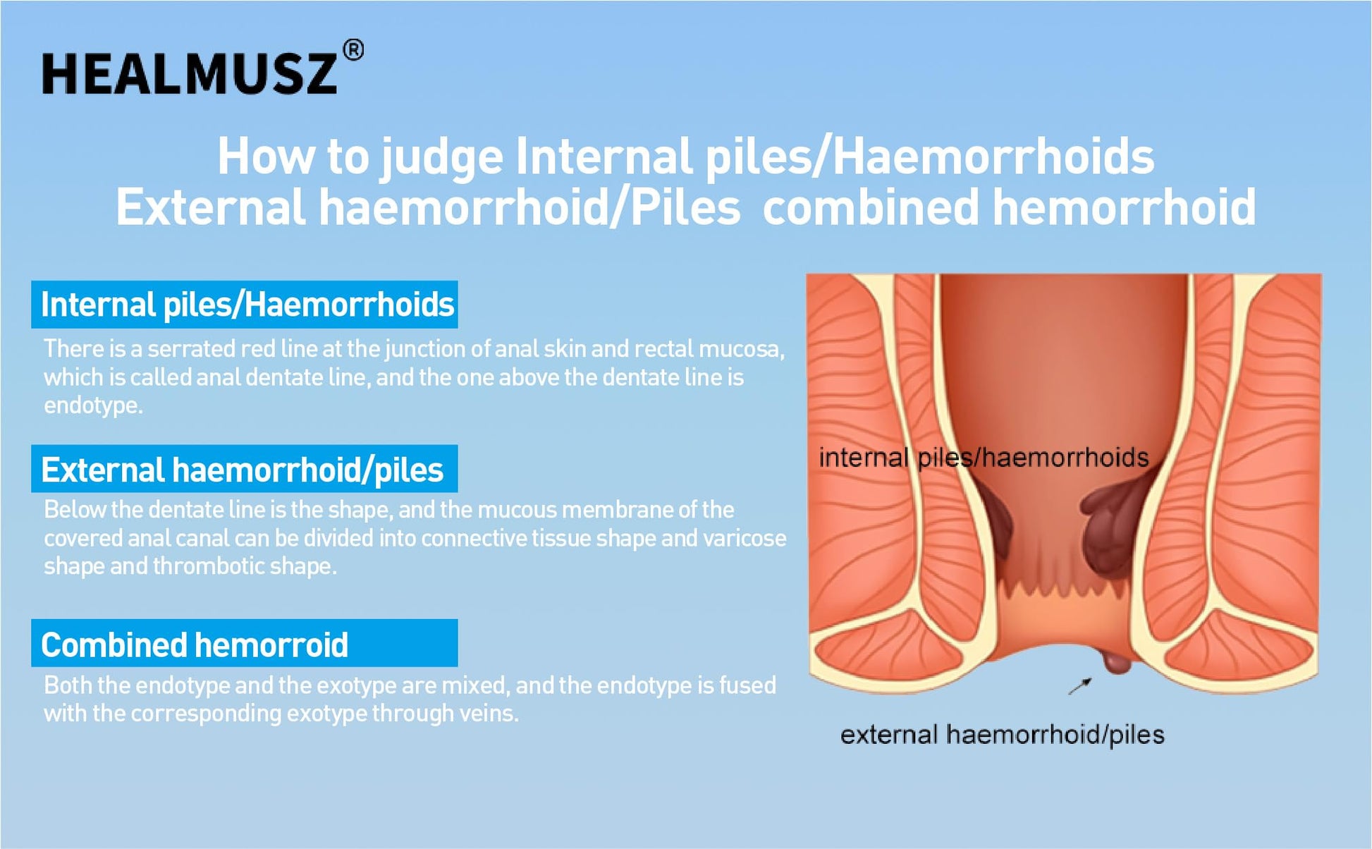 HEALMUSZ Hemorrhoid Fissure Ointment– Hemorrhoid Treatment and Hemorrhoid Cream with Lidocaine and Phenylephrine HCI for Fast Acting Relief of Pain, Swelling, Discomfort, and Itching(1.5 oz) HEALMUSZ Au supplements
