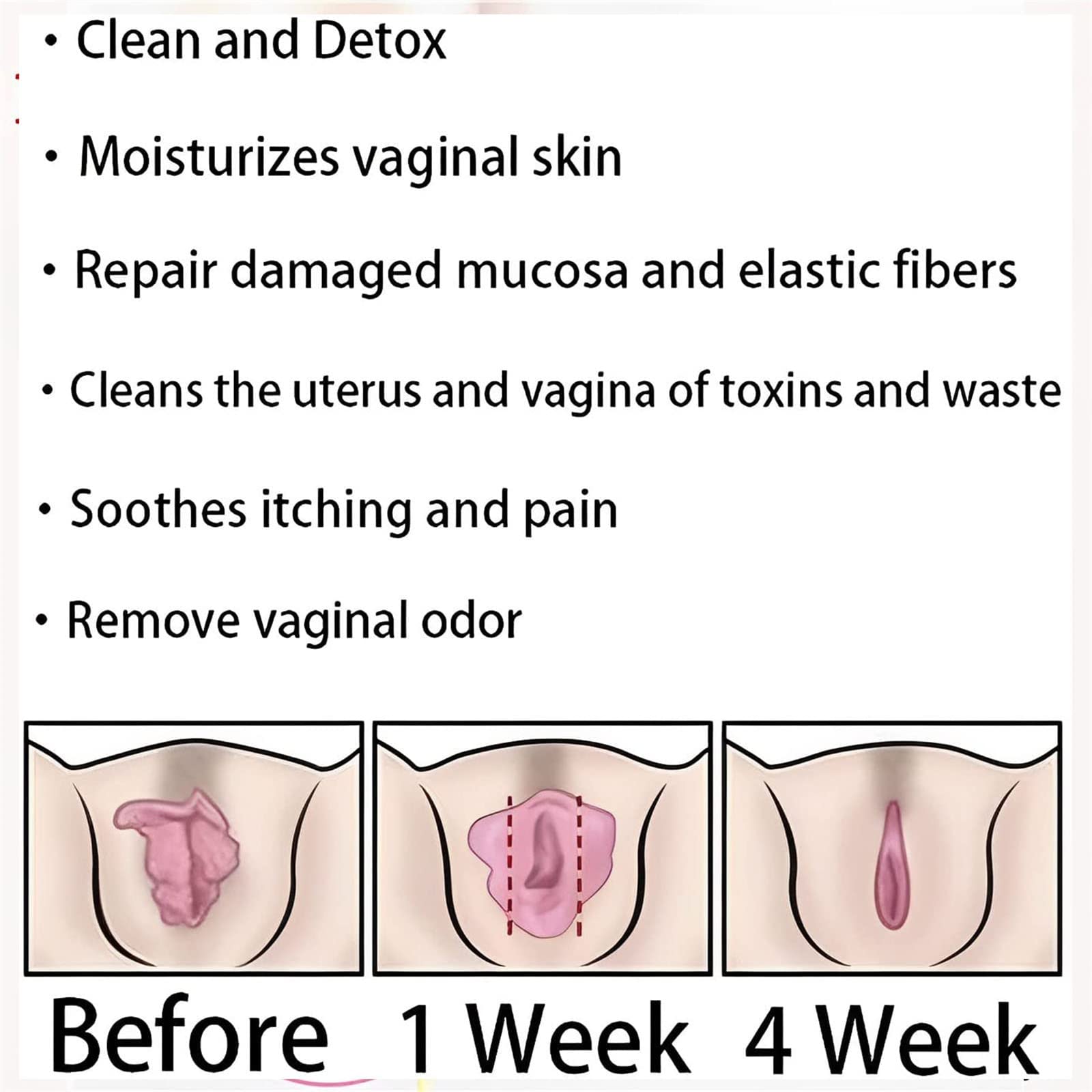 AnnieCare Instant Anti-Itch Detox Slimming Products, Annie Care Natural Detox Viginal Gel DASHENRAN Au supplements