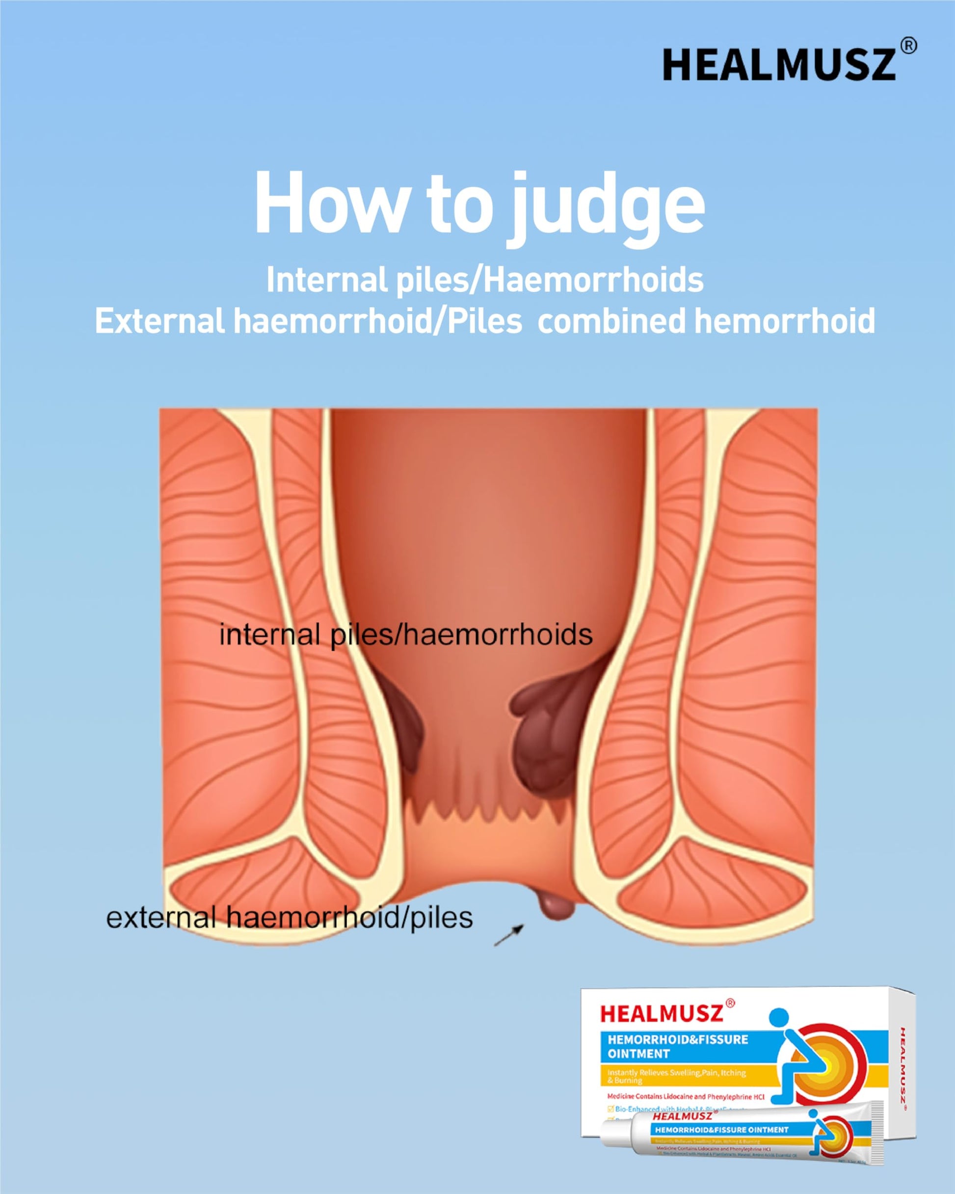 HEALMUSZ Hemorrhoid Fissure Ointment– Hemorrhoid Treatment and Hemorrhoid Cream with Lidocaine and Phenylephrine HCI for Fast Acting Relief of Pain, Swelling, Discomfort, and Itching(1.5 oz) HEALMUSZ Au supplements