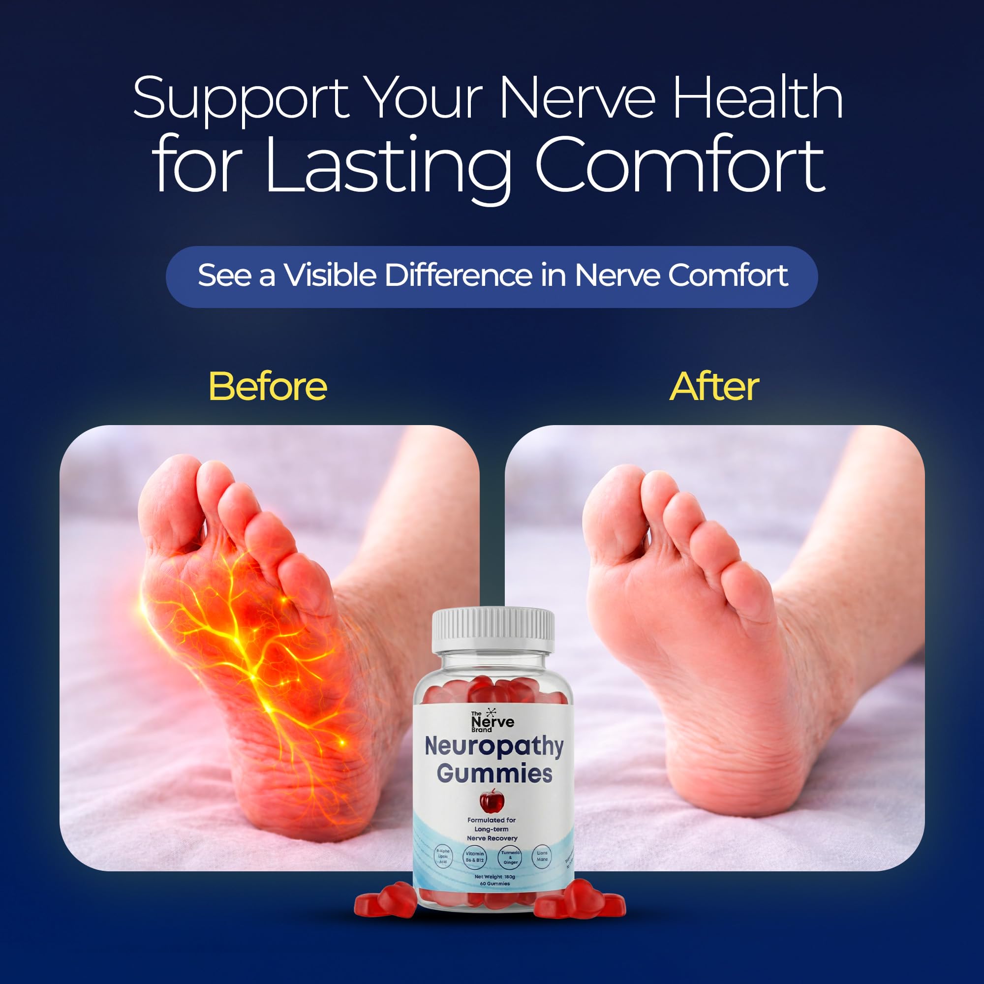 The Nerve Brand Neuropathy Support Gummies, 600 mg R Alpha Lipoic Acid Gummies with B1 B6 B12 and Lion’s Mane, Sugar Free Daily Nerve Health Supplement, 30 Day Supply The Nerve Brand Au supplements
