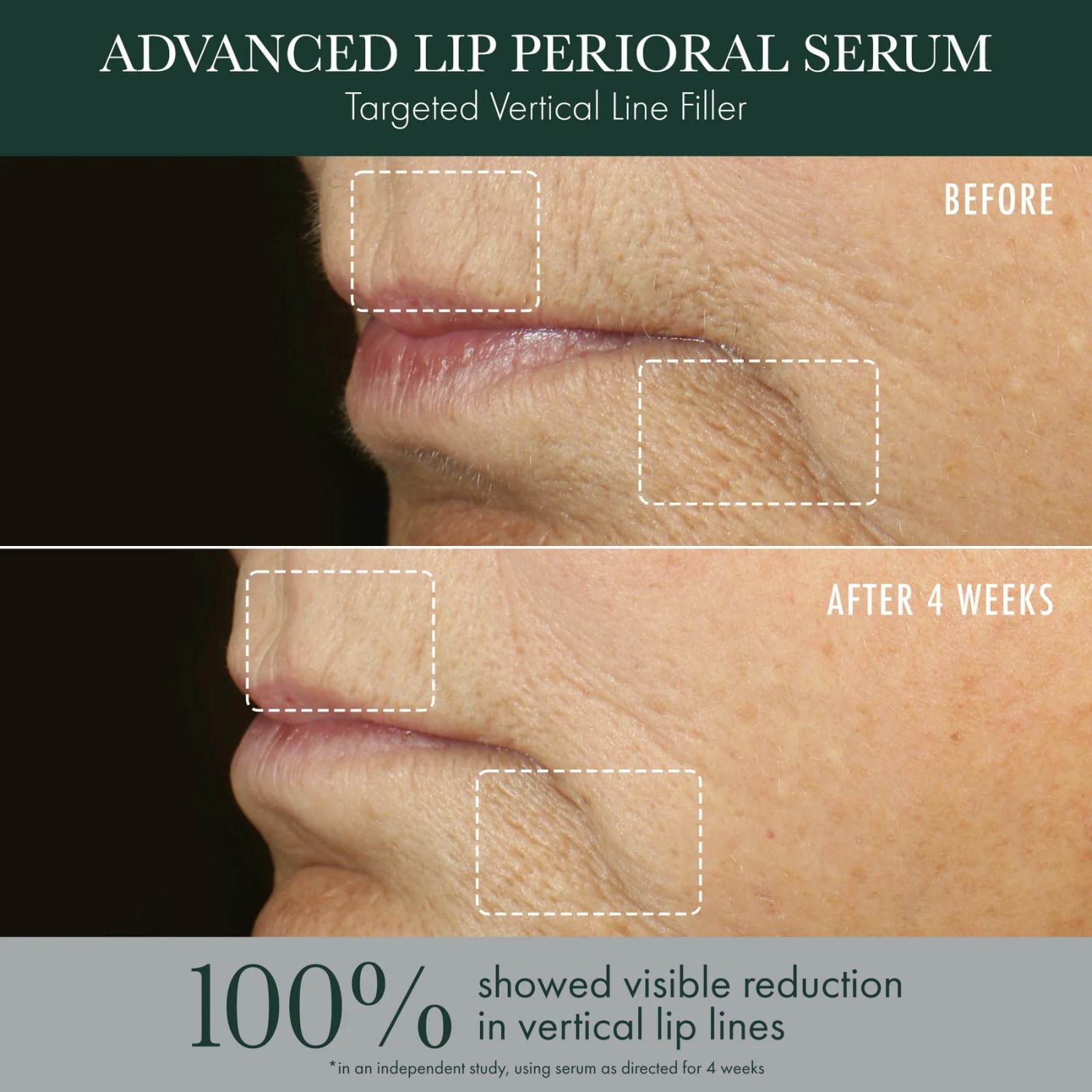 RéVive Advanced Perioral Lip Serum - Anti Aging Perioral Lip Treatment to Reduce Lip Area Lines & Wrinkles -Helps Restore Lip Contour & Visible Fullness(0.5 fl oz) RéVive Au supplements