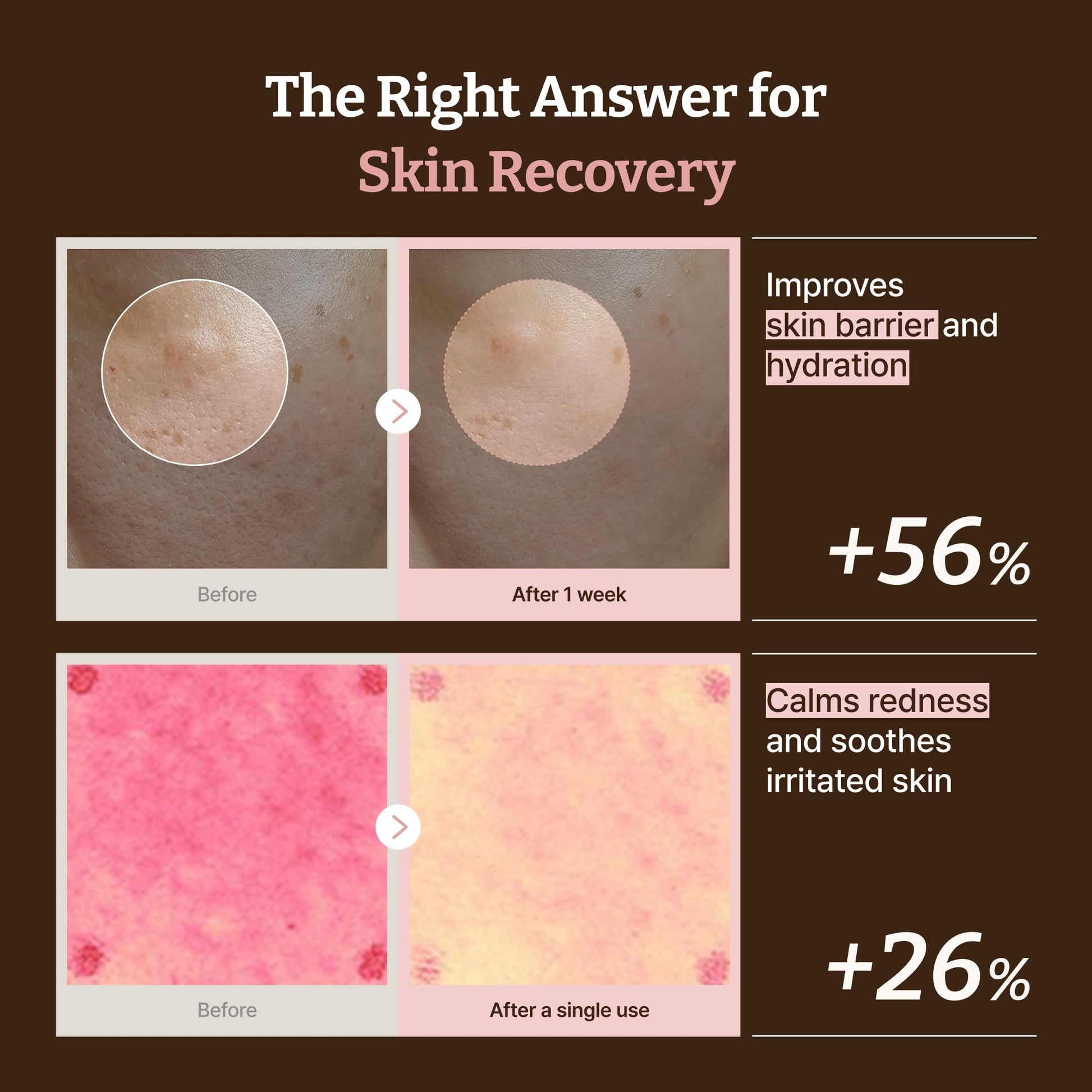 Dr.Reju-All PDRN All-Day Glow Duo: Advanced PDRN Rejuvenating Cream + Advanced PDRN Rejuvenating Mask - Face Moisturizer & Facial Mask for Hydration & Plumping - Korean Skin Care Daily Routine Dr.Reju-All buy supplements Au