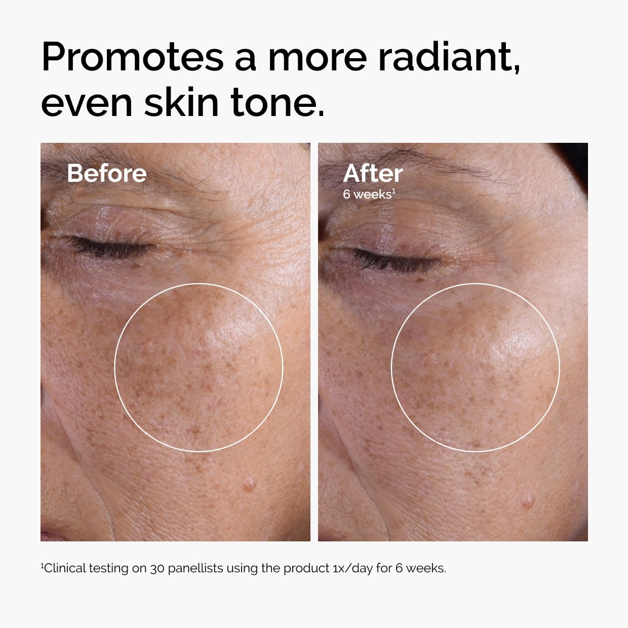 The Ordinary Glycolic Acid 7% Exfoliating Toner, Brightening and Smoothing Daily Toner for More Even-Looking Skin Tone, 8.1 Fl Oz The Ordinary Au supplements