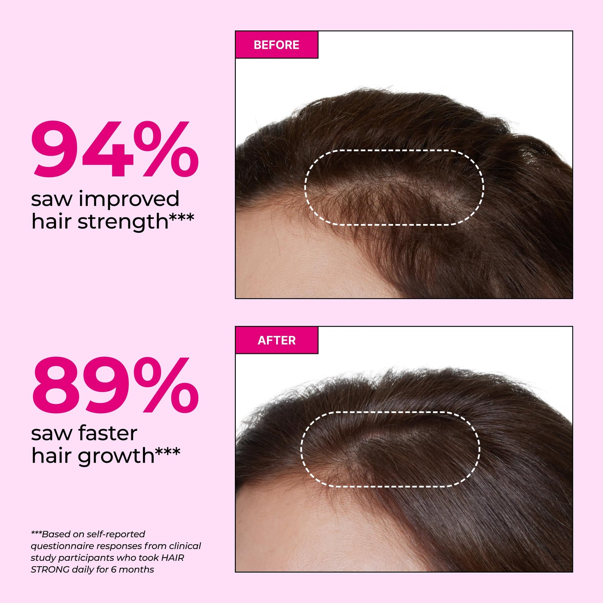 HUM Hair Strong Daily Hair Growth Gummies with Biotin, Zinc, Vitamin B12 to Support Growth, Folic Acid & Vitamin B12 Gummy Vitamins for Healthy Hair Support for Women and Men, 60 Gummies HUM Au supplements
