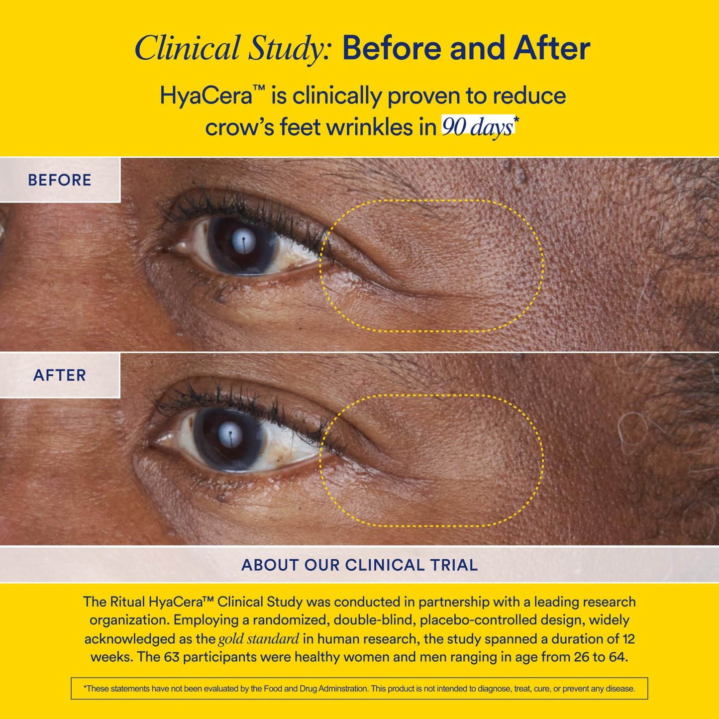 Ritual Hyaluronic Acid Skin Supplement - With Hyabest® and Ceratiq® - HyaCera Clinically Proven to Reduce Wrinkles, Fine Lines & Improve Skin Smoothness RitualUS supplements