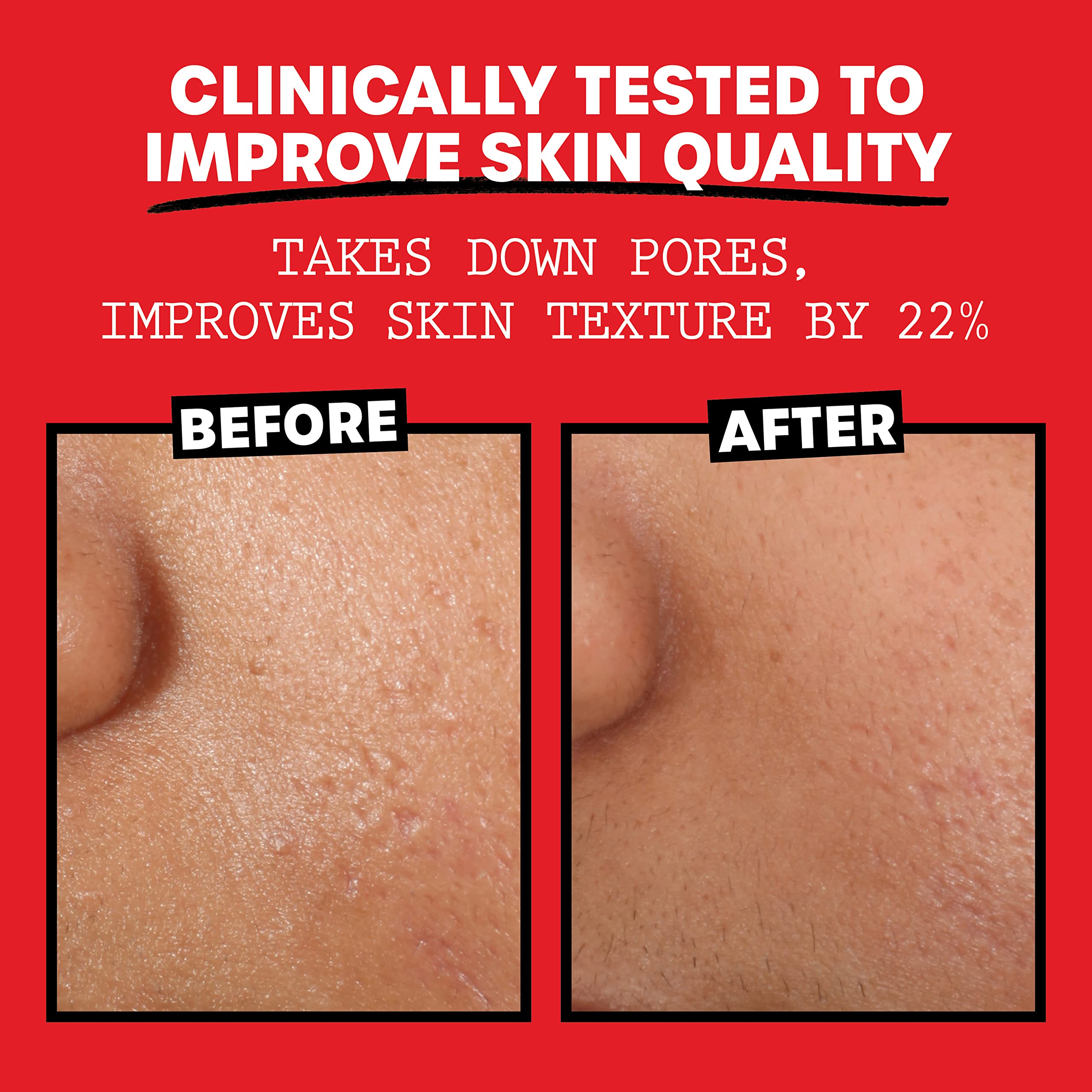 Thayers Alcohol-Free, Hydrating Rose Petal Witch Hazel Facial Toner 12 oz + 3oz THAYERS Au supplements