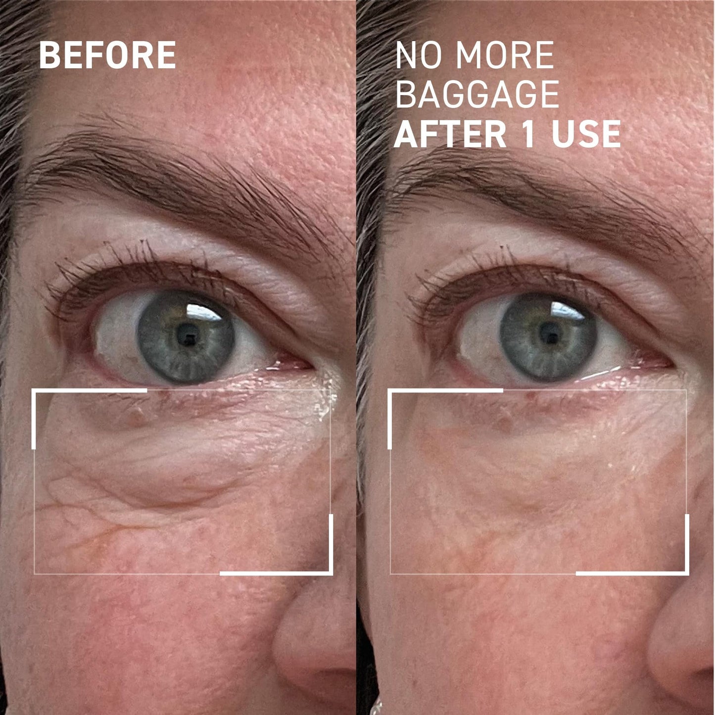 Dr. Brandt Needles No More, No More Baggage - Minimizes Under-Eye Bags, Puffiness & Dark Circles - 0.5 oz Dr. Brandt Skincare buy supplements Au