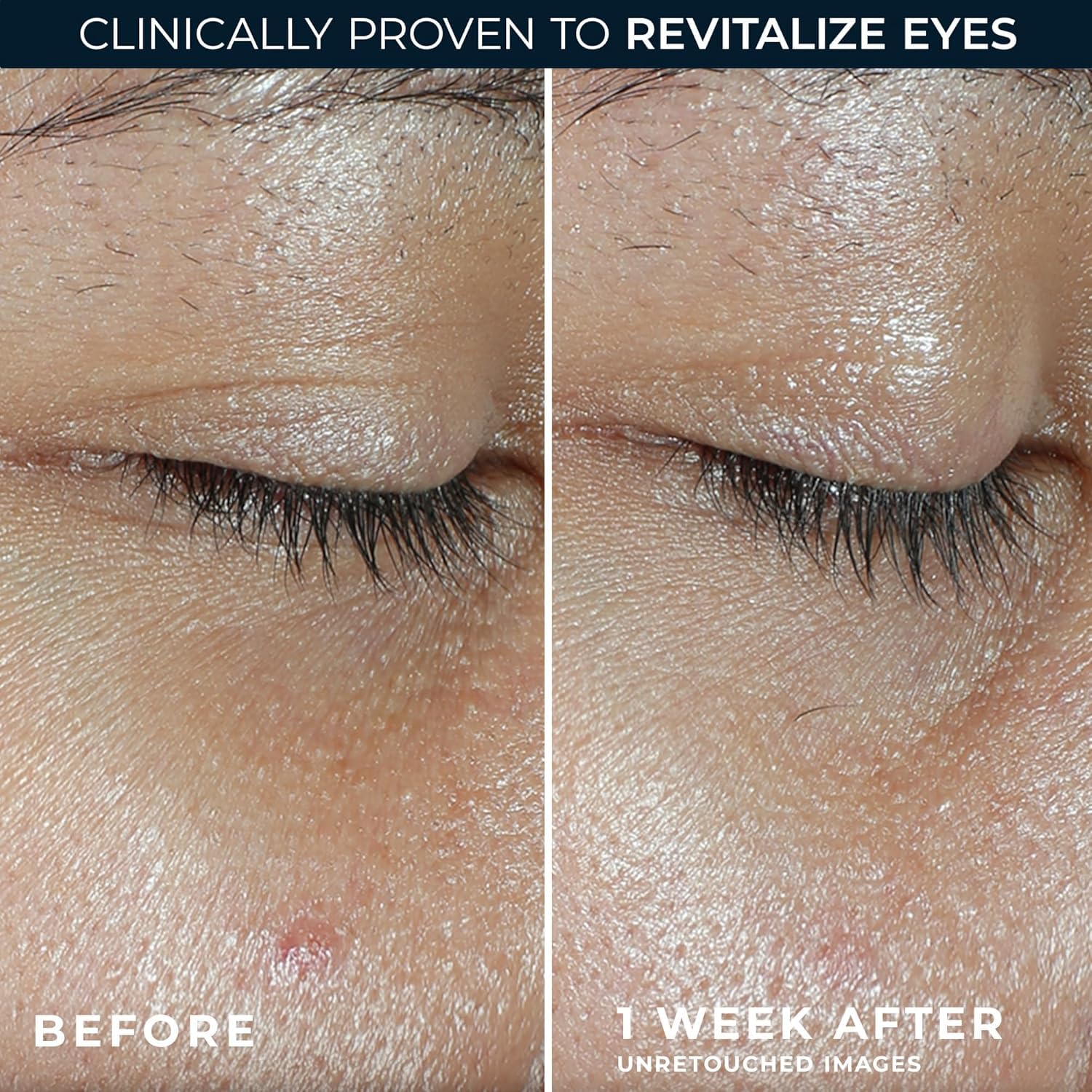 RoC Multi Correxion Revive + Glow Eye Balm with Vitamin C (0.14 oz) + Retinol Eye Cream Packette