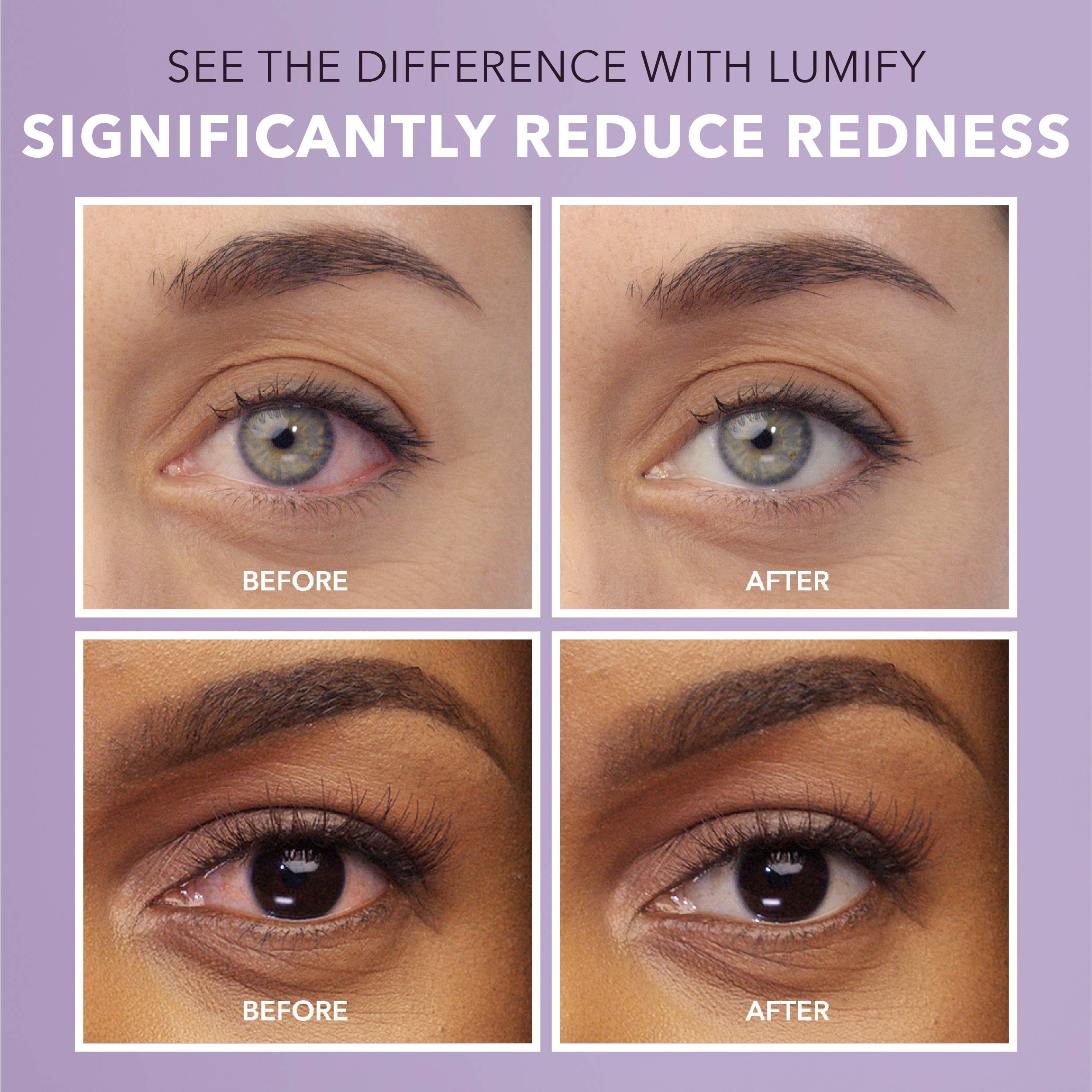 LUMIFY Eye Drops for Red Eyes, Redness Reliever for Brighter Looking Eyes, Works in 1 Minute & Lasts Up to 8 Hours, Eye Drops, 0.25 Fl Oz (7.5mL) LUMIFY Au supplements